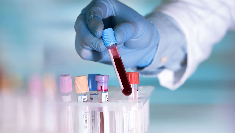Sample Collection & Lab Test at Home
